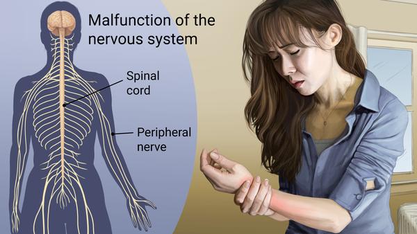 Life with CRPS: Suicide Disease: Burning&nbsp;Alive.